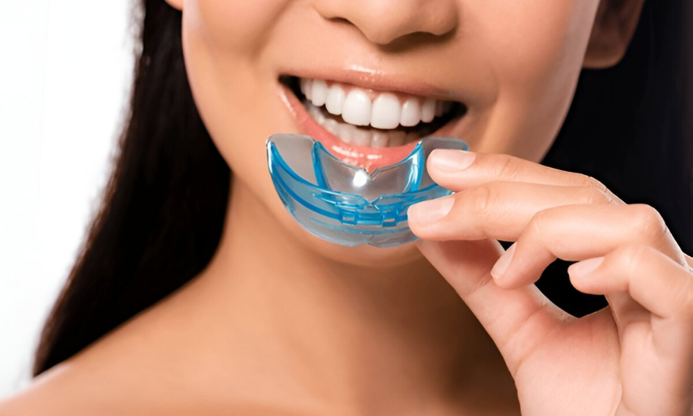 Bruxism Night Guard Edmonton – Do You Need One?
