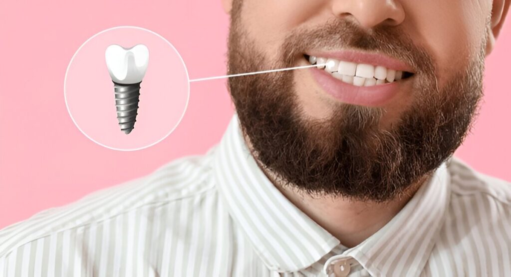 Dental Implants Edmonton AB